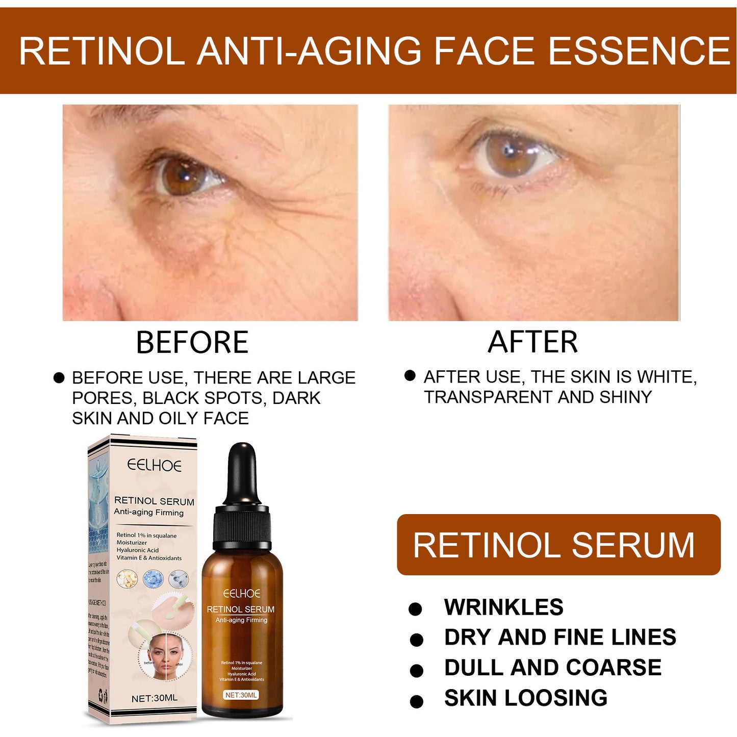 EELHOE Retinol Face Serum, Lightening Fine Lines, Hydrating, Firming, Anti Aging A Pple Skin Repair E Ssence