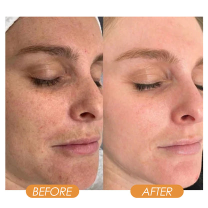 West&Month Collagen Eye Mask Spray, Anti-Aging Recombination Anti-Wrinkle Hydrating Anti-Aging Spray