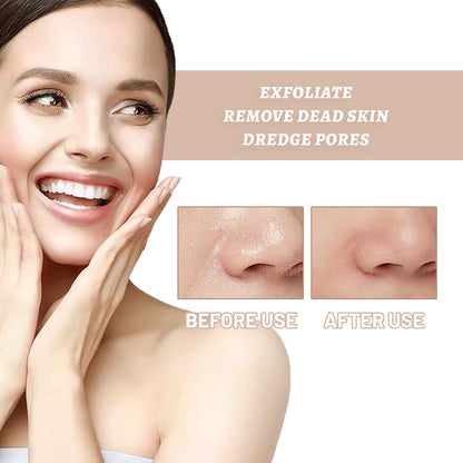 OUHOE Purifying Exfoliating Gel, Skin Mildly Tender Skin Cutin Clean Pores Blackhead Gel