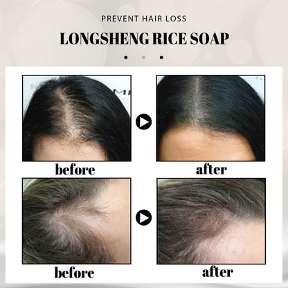 EELHOE Longsheng Rice Shampoo Soap, Soothing Scalp Cleaning And Smoothing Hair, Longsheng Rice Handmade Soap