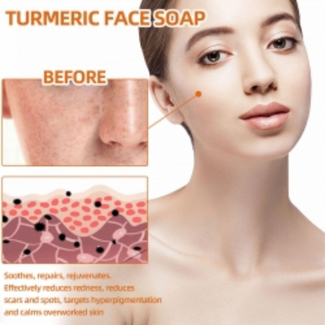 West&Month Turmeric Face Soap, Face Repair Gentle Cleansing, Fade Spots And Smooth Fine Lines Cleaner Soap