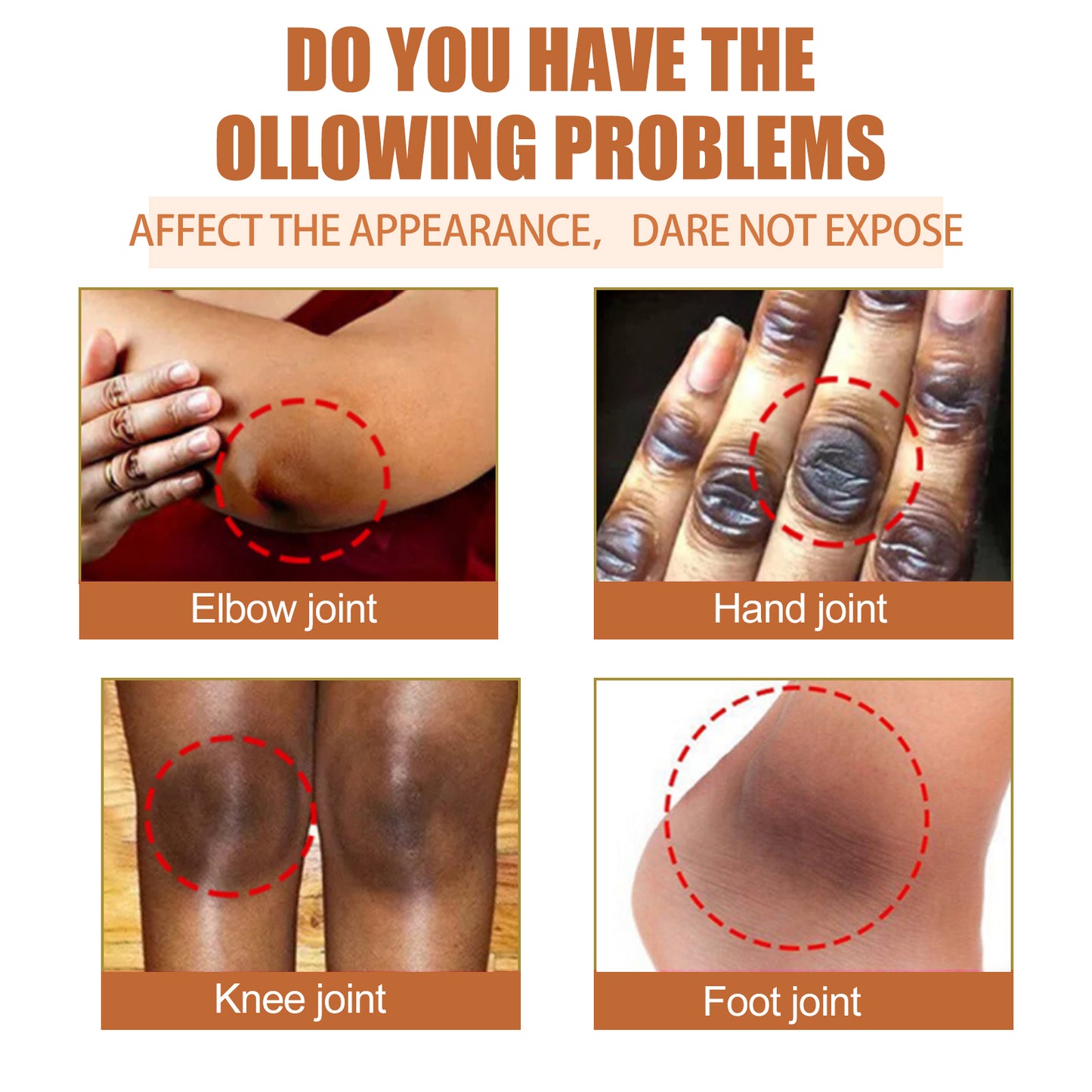 Papaya Seed Oil To Remove Dark Spots