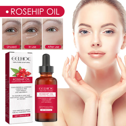 Rosehip Facial Oil