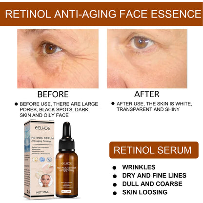 EELHOE Retinol Face Serum, Lightening Fine Lines, Hydrating, Firming, Anti Aging A Pple Skin Repair E Ssence