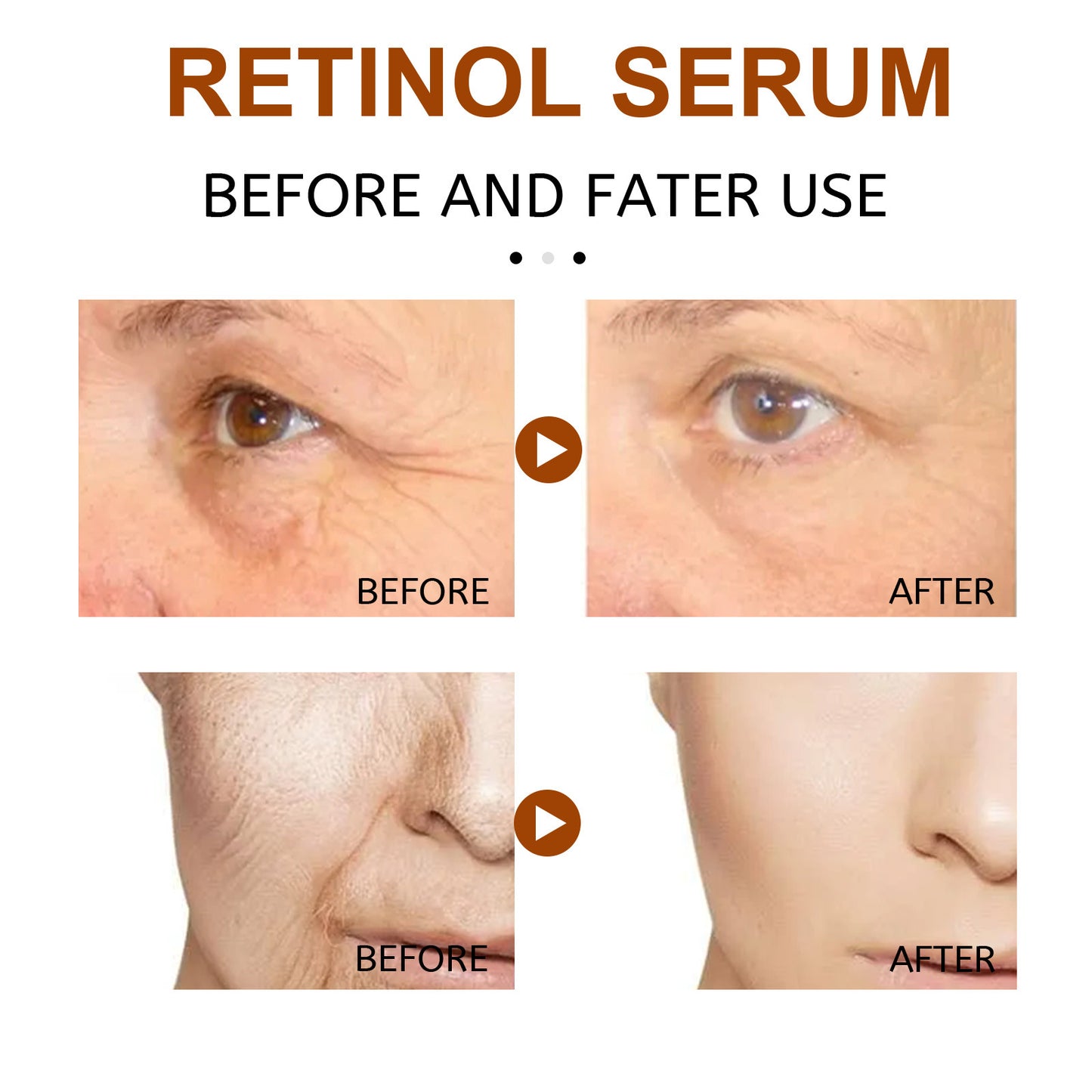 EELHOE Retinol Face Serum, Lightening Fine Lines, Hydrating, Firming, Anti Aging A Pple Skin Repair E Ssence