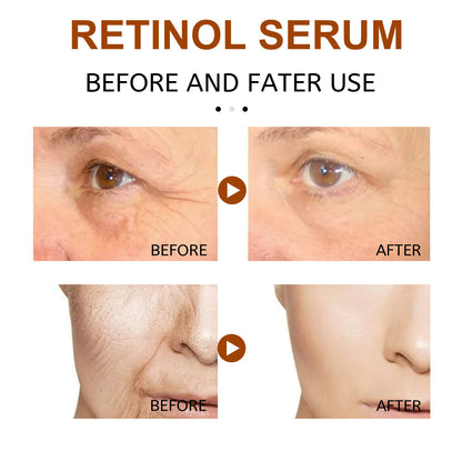 EELHOE Retinol Face Serum, Lightening Fine Lines, Hydrating, Firming, Anti Aging A Pple Skin Repair E Ssence