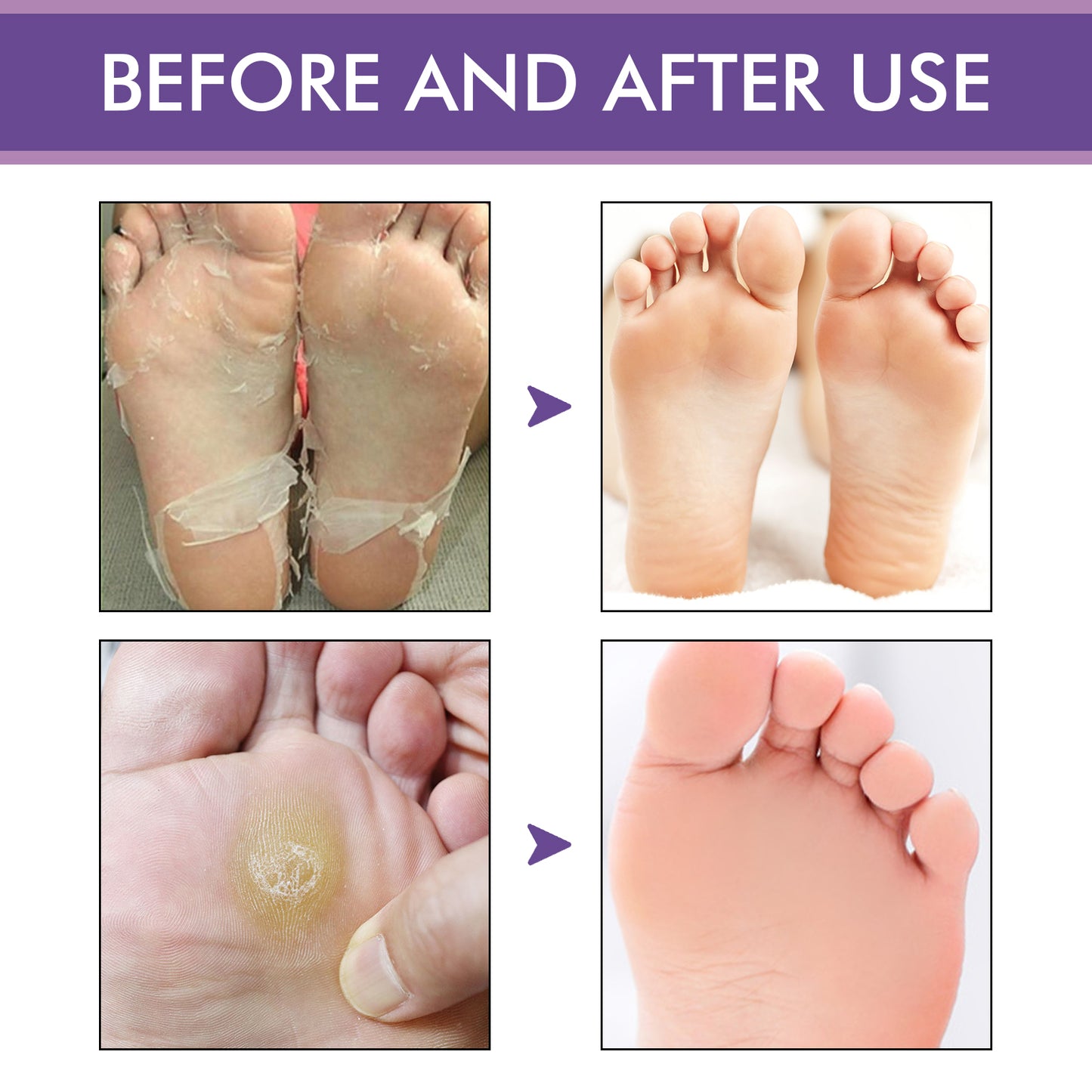 West&Month Lavender Peel Mask, Moisturizing Foot Cleansing Keratin Anti-cracking And Dead Skin Care Foot Mask