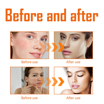 West&Month Turmeric Toner, Deep Hydrating Firming And Moisturizing Facial Skin Toner