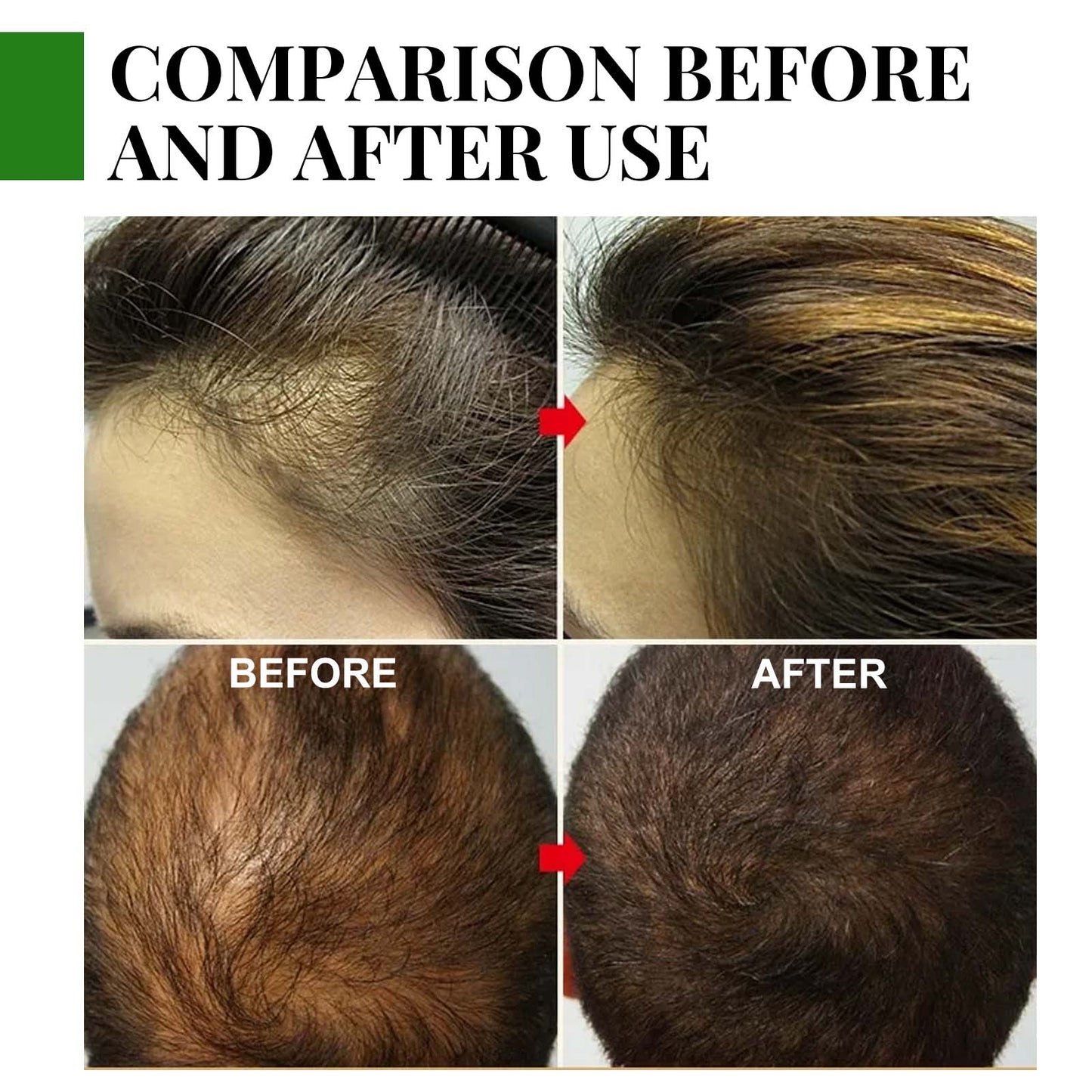 EELHOE Rosemary Oil Capsules, Nourish Hair Roots Prevent The Loss Of Solid Hair And Hair Moisturizing Hair Care Essential Oil