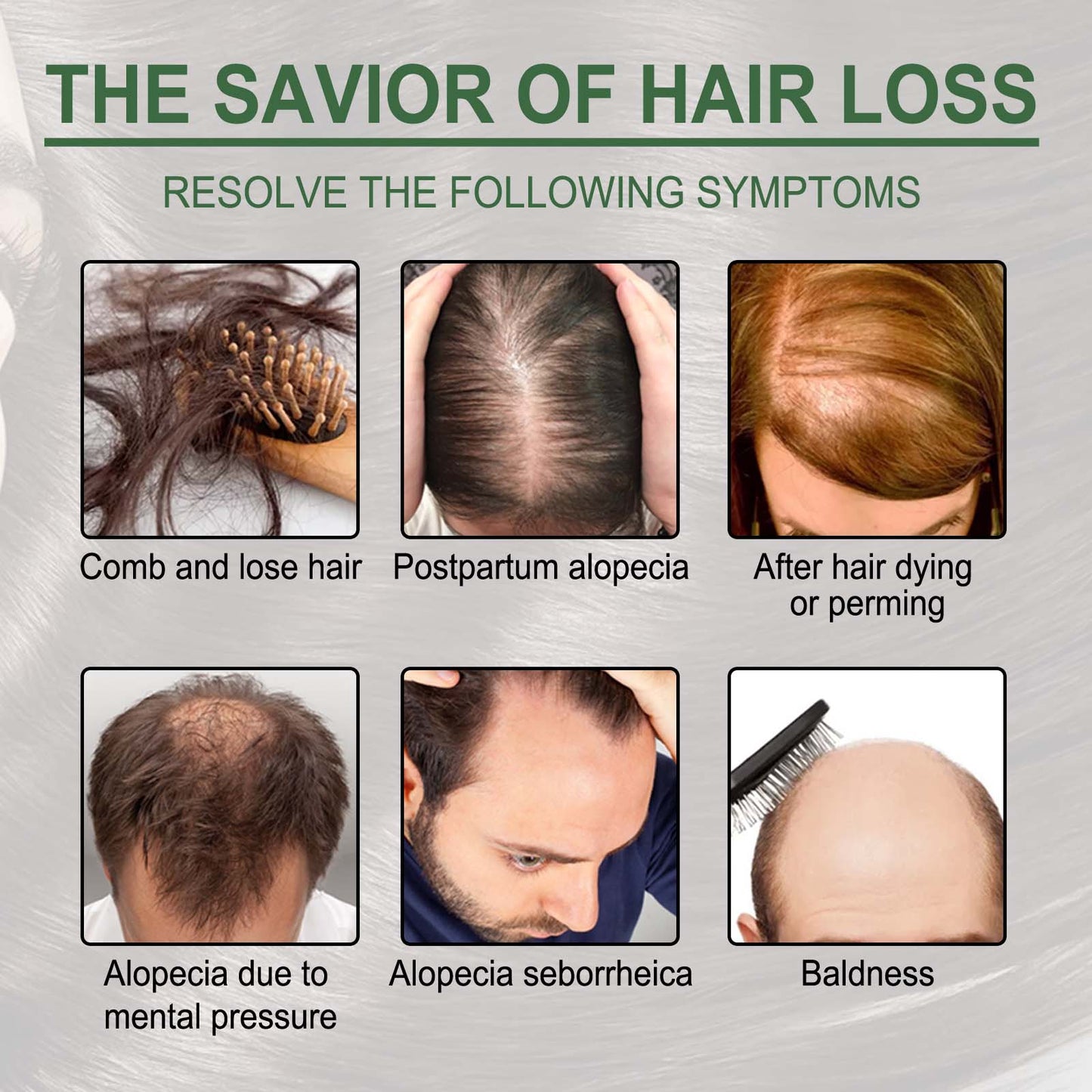 EELHOE Rosemary Oil Capsules, Nourish Hair Roots Prevent The Loss Of Solid Hair And Hair Moisturizing Hair Care Essential Oil