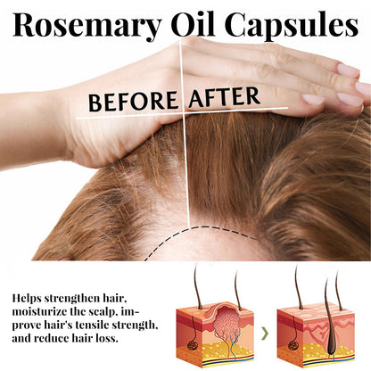 EELHOE Rosemary Oil Capsules, Nourish Hair Roots Prevent The Loss Of Solid Hair And Hair Moisturizing Hair Care Essential Oil