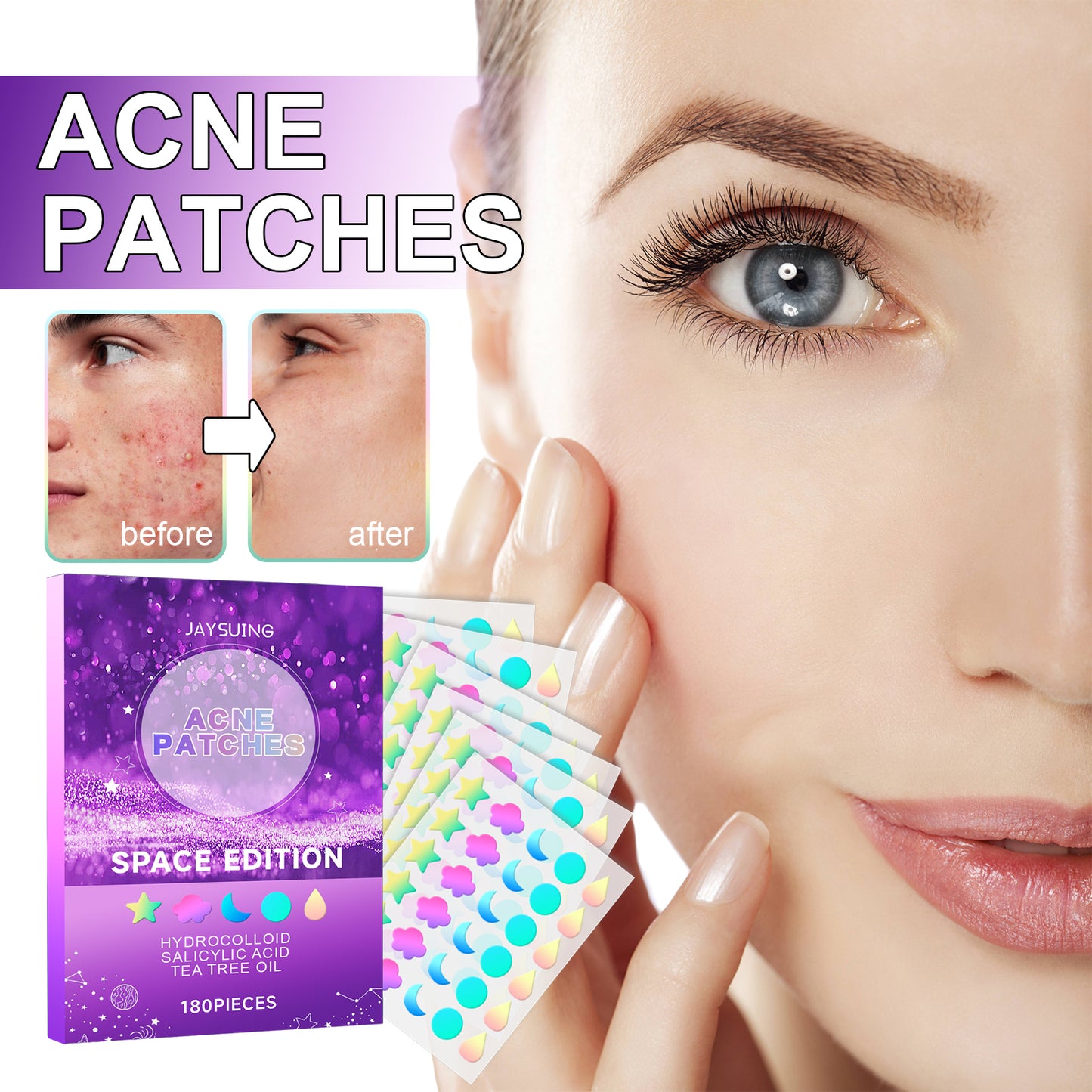 Jaysuing Acne Patches, Lightening Facial Acne Pimples Closed Repair Balance Skin Delicate Pore Care