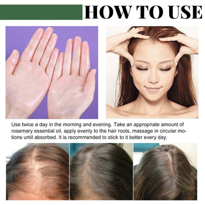 EELHOE Rosemary Oil Capsules, Nourish Hair Roots Prevent The Loss Of Solid Hair And Hair Moisturizing Hair Care Essential Oil