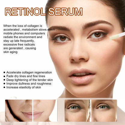 EELHOE Retinol Face Serum, Lightening Fine Lines, Hydrating, Firming, Anti Aging A Pple Skin Repair E Ssence