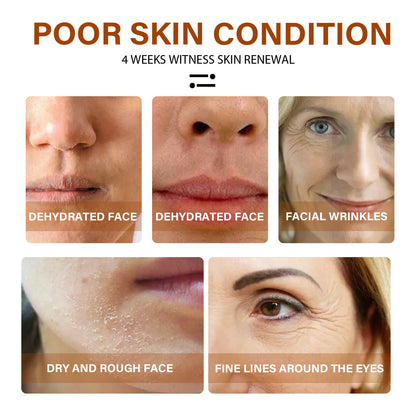 EELHOE Retinol Face Serum, Lightening Fine Lines, Hydrating, Firming, Anti Aging A Pple Skin Repair E Ssence