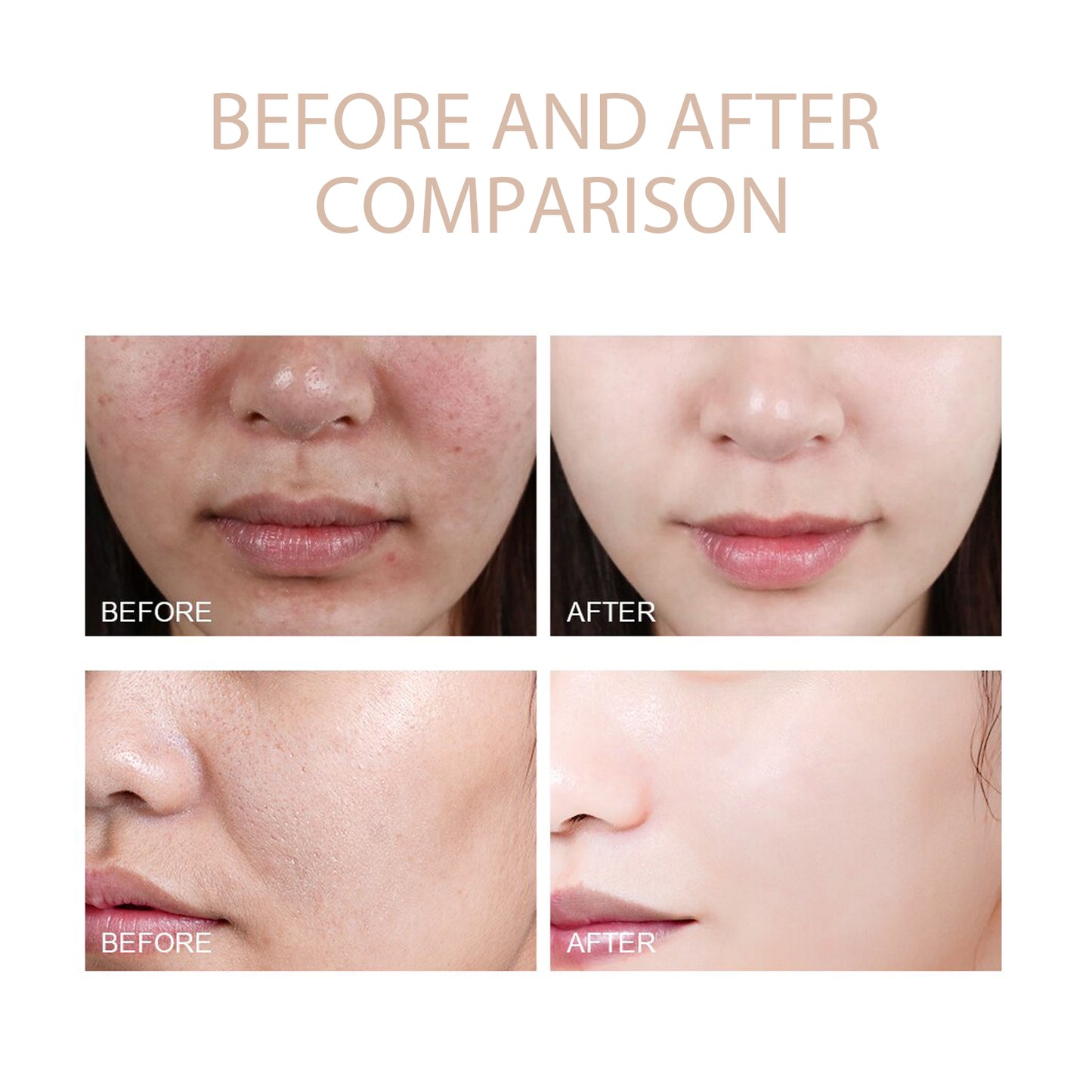 OUHOE Purifying Exfoliating Gel, Skin Mildly Tender Skin Cutin Clean Pores Blackhead Gel